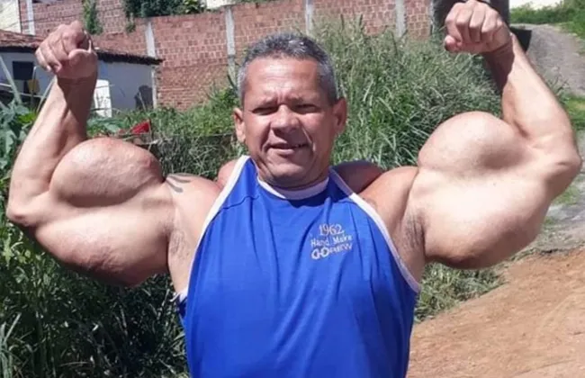 Imagem ilustrativa da imagem 