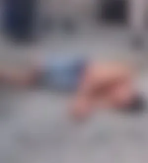 Imagem ilustrativa da imagem Homem fica desacordado após pedrada no rosto durante briga na Bahia