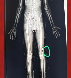 Imagem ilustrativa da imagem Salvador: funcionário é preso ao tentar entrar com drogas em presídio