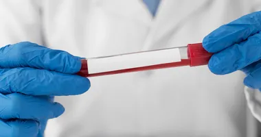 Imagem ilustrativa da imagem Bahia passa a oferecer exame genético inovador para doenças raras