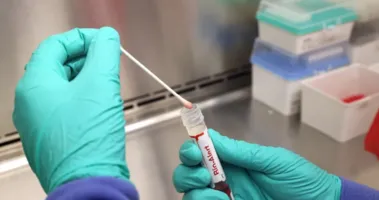 Imagem ilustrativa da imagem Caso suspeito de Mpox é registrado no interior da Bahia