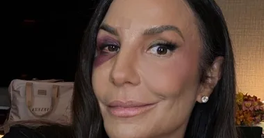 Imagem ilustrativa da imagem Ivete Sangalo passa por nova cirurgia e amigo tranquiliza fãs
