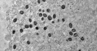 Imagem ilustrativa da imagem Mpox, sarampo ou catapora? Saiba como diferenciar as doenças