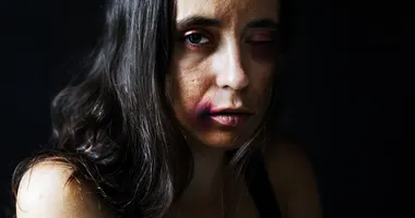 Imagem ilustrativa da imagem Mulher leva garrafada na cabeça após dizer não a agressor