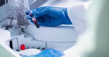 Imagem ilustrativa da imagem Mulher se relaciona com gêmeos e exame de DNA não aponta quem é o pai