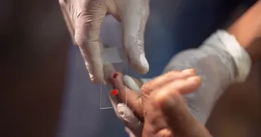 Imagem ilustrativa da imagem Novo tratamento contra malária para crianças começa a chegar ao SUS