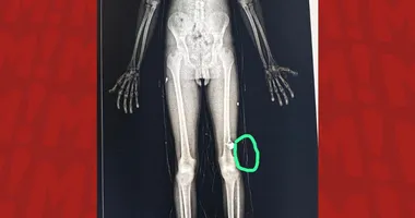 Imagem ilustrativa da imagem Salvador: funcionário é preso ao tentar entrar com drogas em presídio