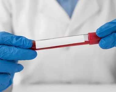 Sangue coletado para exame