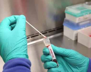 Resultado dos exames é aguardado para confirmar ou descartar a suspeita