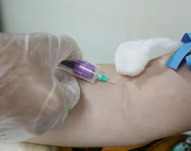 Para doar, a pessoa precisa ser considerada apta na avaliação clínica realizada pelo serviço de hemoterapia