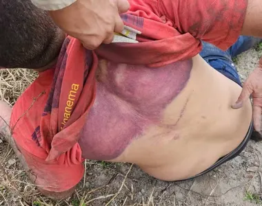 Motorista foi torturado