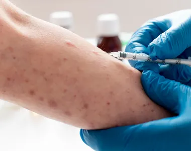 Bahia tem 7 casos notificados em 2026