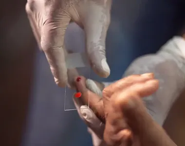 Brasil é o primeiro país a liberar o tratamento infantil