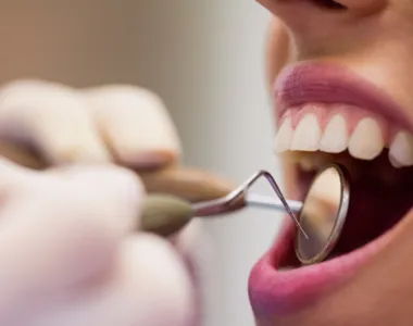 Serviços fazem parte da rede pública de saúde bucal da cidade