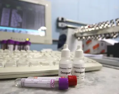 Novo teste entrou na tabela de procedimentos do SUS