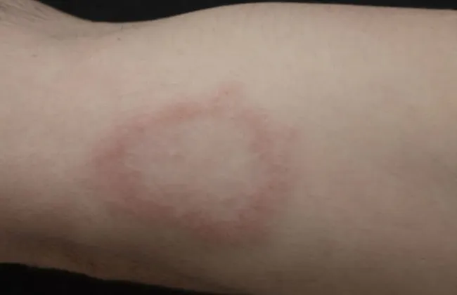 Imagem ilustrativa da imagem 