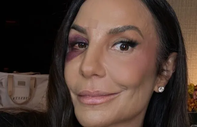 Imagem ilustrativa da imagem 