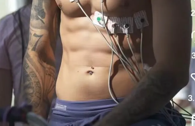 Imagem ilustrativa da imagem 