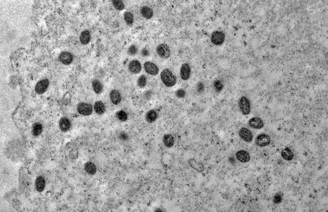 Imagem ilustrativa da imagem 