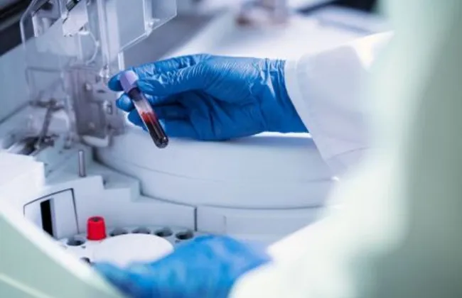 Imagem ilustrativa da imagem 