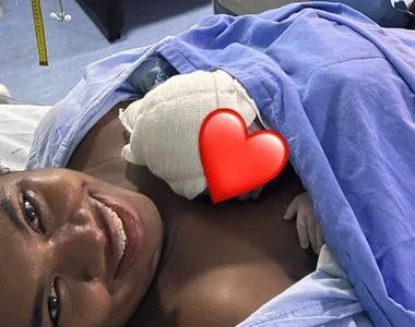 Raquel já havia relatado sobre ataques a aparência da criança