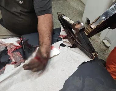 Bombeiros utilizaram um expansor elétrico para livrar a mão da vítima