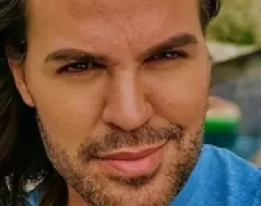 Eduardo Costa esclareceu que está passando por um transplante capilar