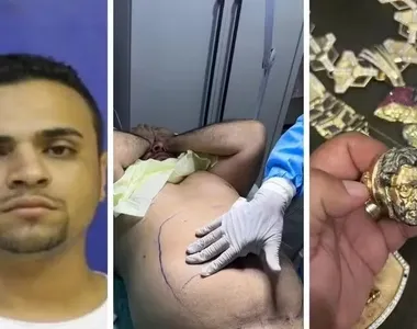 "Professor" passou por lipoaspiração dentro de casa