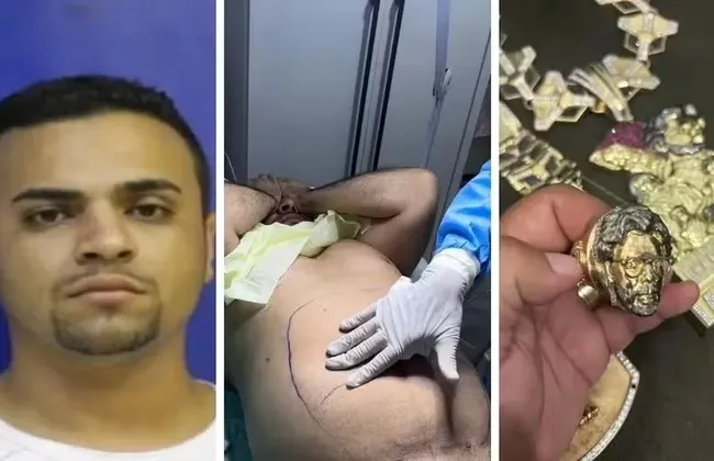 Imagem ilustrativa da imagem 