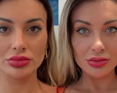 Andressa Urach mudou a cor dos olhos