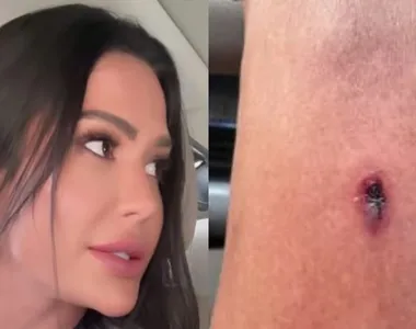 Gracyanne Barbosa sofreu acidente