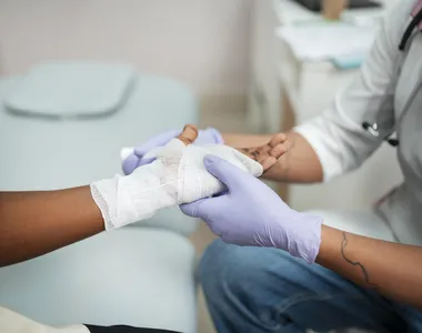 Casos de queimaduras aumentam durante o São João