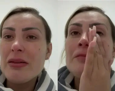 A ex- miss Bumbum revelou que chegouno limite