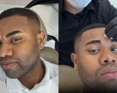 Davi Brito fez mais um procedimento estético no rosto