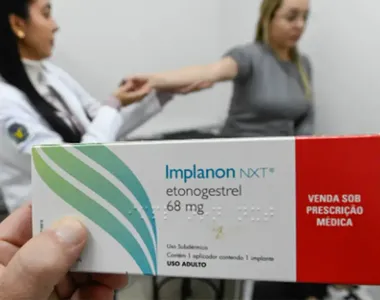 Anticoncepcional Implanon
