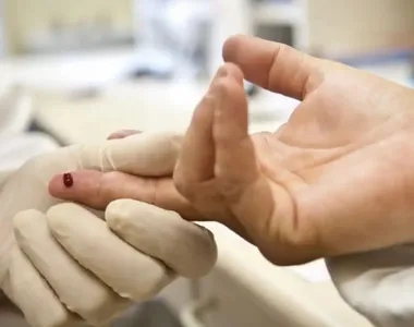 Sesab desmente surto de HIV entre os jovens na Bahia