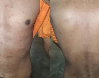 Detentos contaminados foram isolados