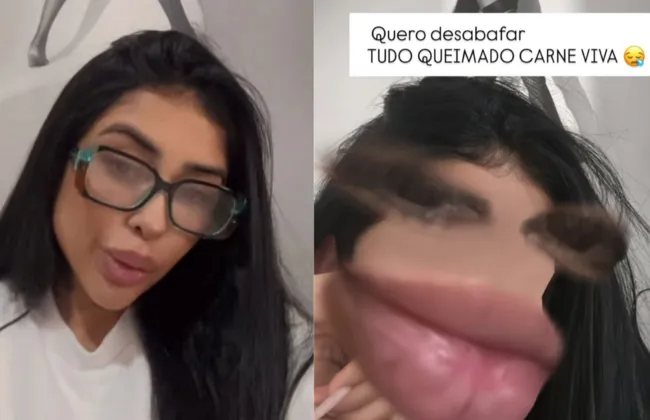 Imagem ilustrativa da imagem 