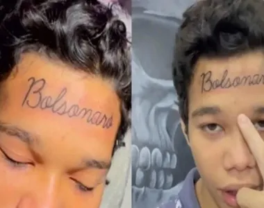 Jovem remove tatuagem de “Bolsonaro” da testa