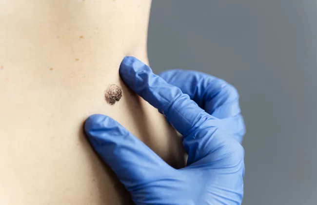 Imagem ilustrativa da imagem 