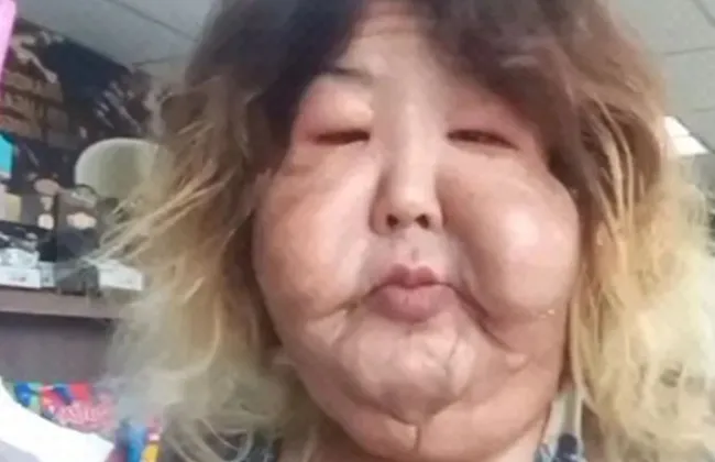 Imagem ilustrativa da imagem 