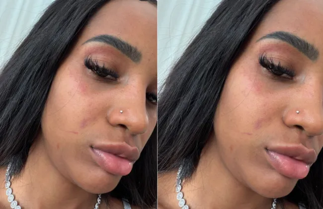 Imagem ilustrativa da imagem 