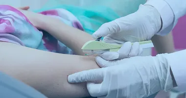 Imagem ilustrativa da imagem Implanon: o que é e como funciona o anticoncepcional disponível no SUS