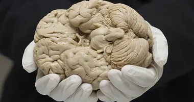 Imagem ilustrativa da imagem Medicamento que promete retardar Alzheimer chega ao Brasil em junho