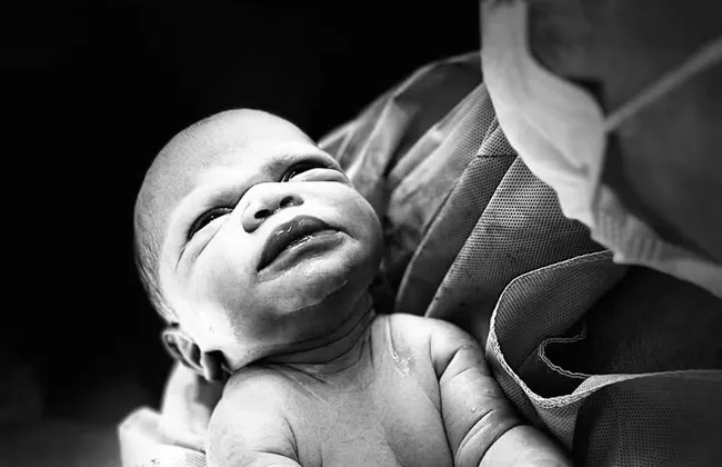 Imagem ilustrativa da imagem 