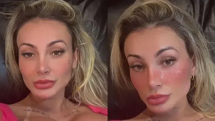 Imagem ilustrativa da imagem "Cara de ninfetinha", dispara Andressa Urach após nova tatuagem