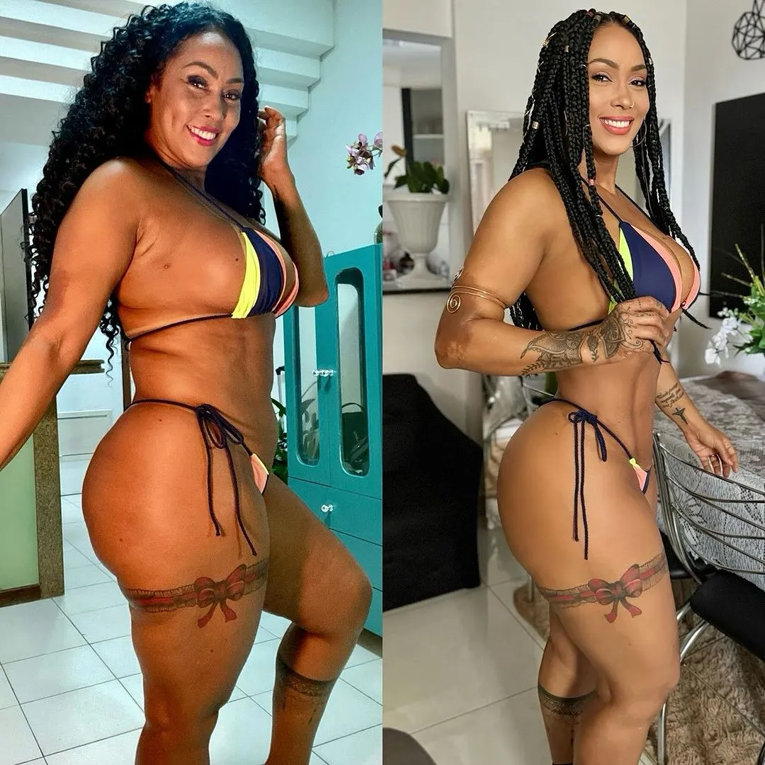 Rosiane Pinheiro mostra resultado da lipoaspiração