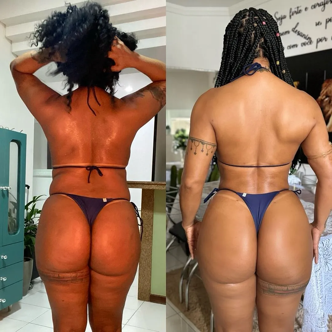 Rosiane Pinheiro mostra resultado da lipoaspiração