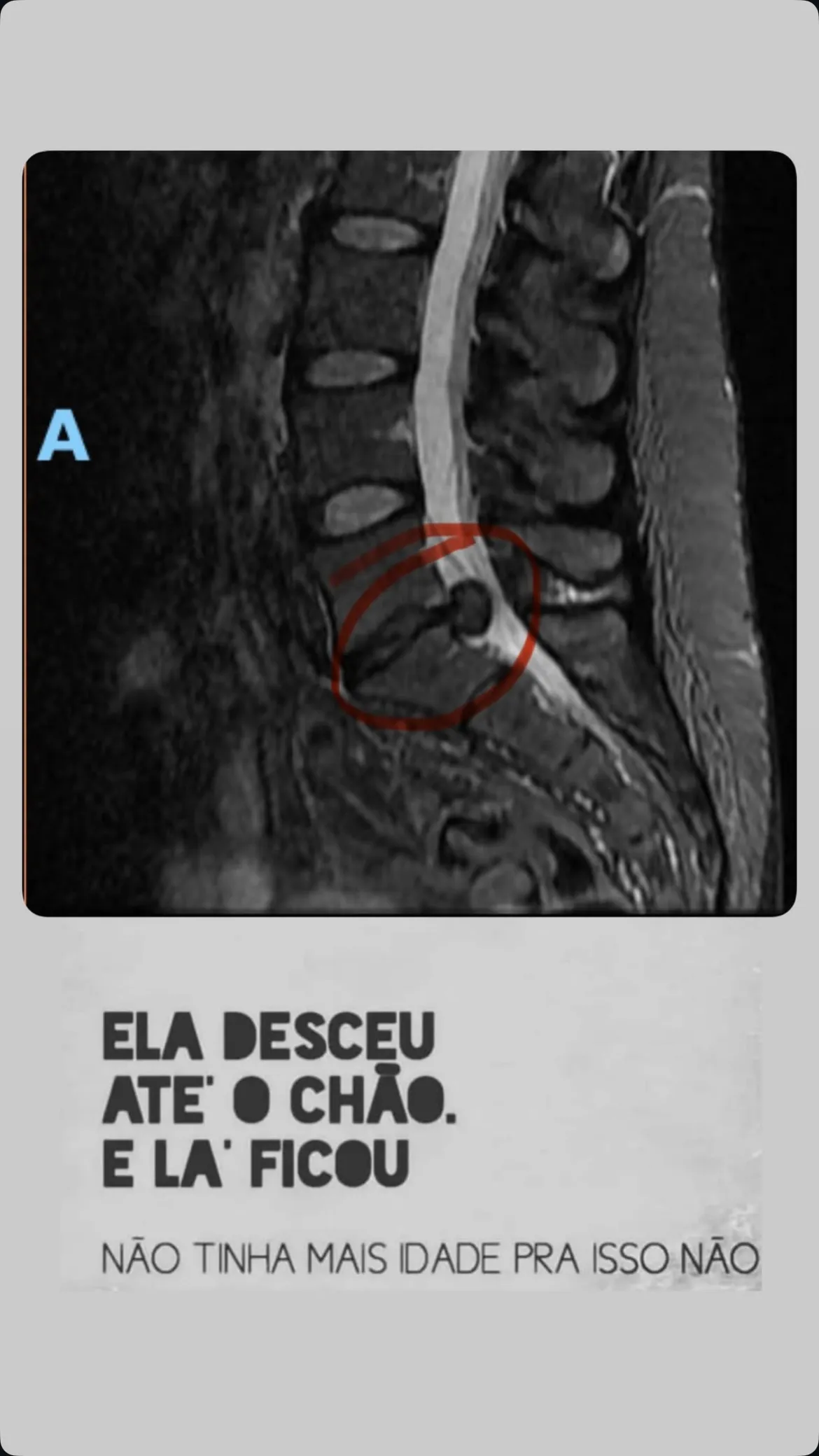 Ana Paula foi internada nesta quinta (15)