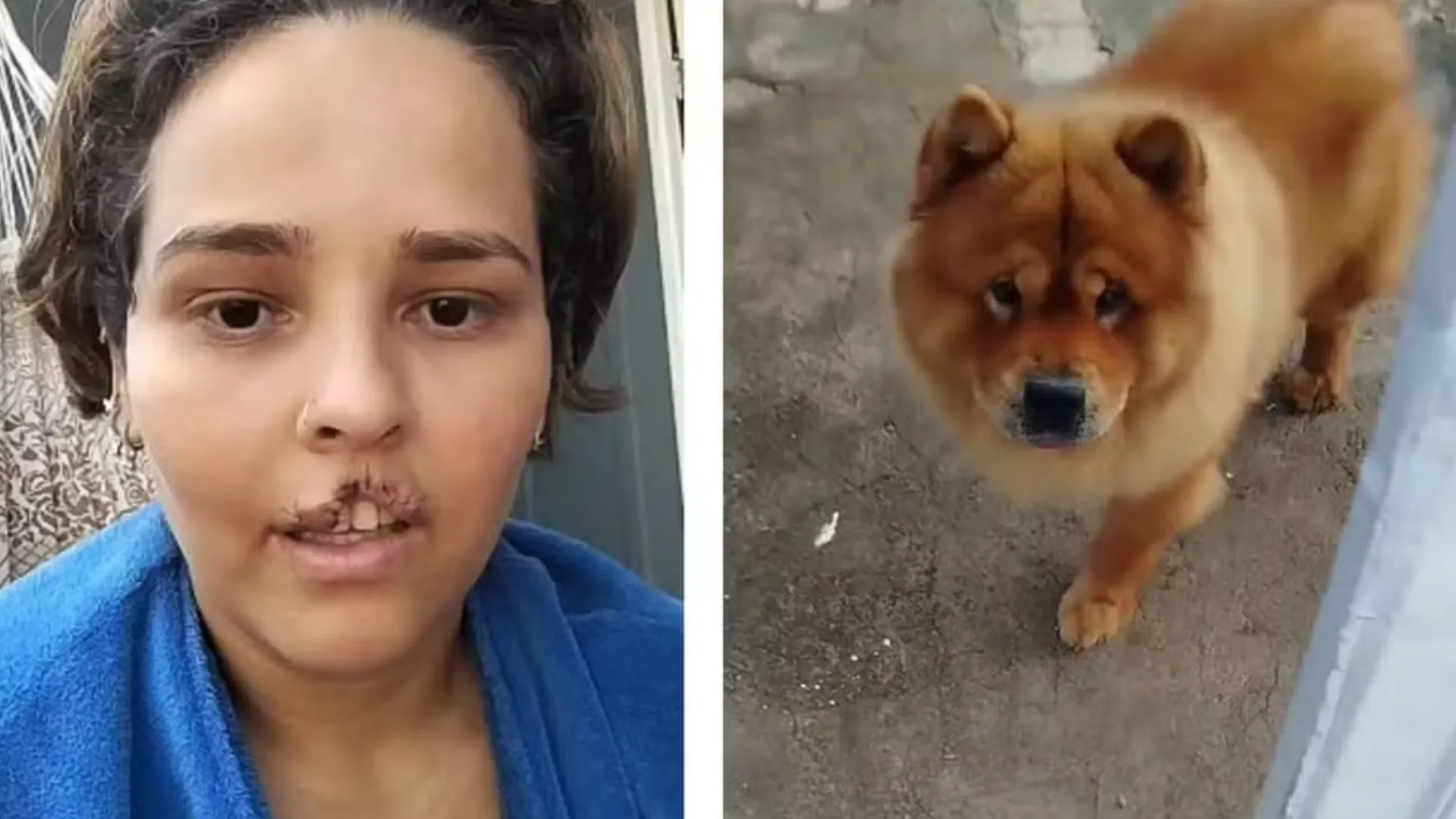 Natani será submetida a uma reconstrução facial